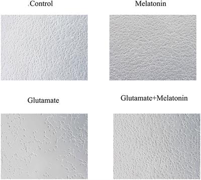 Reduction of Mitophagy-Related Oxidative Stress and Preservation of Mitochondria Function Using Melatonin Therapy in an HT22 Hippocampal Neuronal Cell Model of Glutamate-Induced Excitotoxicity